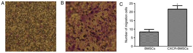 https://cdn.ncbi.nlm.nih.gov/pmc/blobs/59c5/6090451/21af88d398d1/etm-16-02-0821-g05.jpg