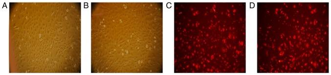 https://cdn.ncbi.nlm.nih.gov/pmc/blobs/59c5/6090451/381ca5a3871d/etm-16-02-0821-g01.jpg