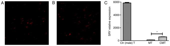 https://cdn.ncbi.nlm.nih.gov/pmc/blobs/59c5/6090451/5c6c60ecbb69/etm-16-02-0821-g06.jpg