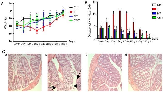 https://cdn.ncbi.nlm.nih.gov/pmc/blobs/59c5/6090451/62e2d48d3eb4/etm-16-02-0821-g07.jpg