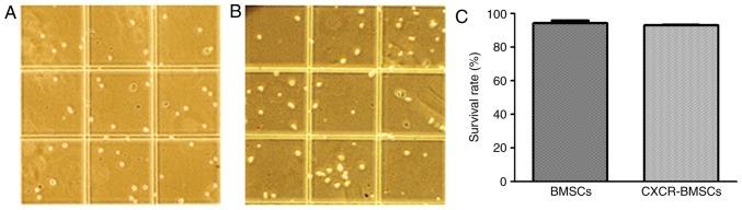https://cdn.ncbi.nlm.nih.gov/pmc/blobs/59c5/6090451/e205dede64b9/etm-16-02-0821-g04.jpg