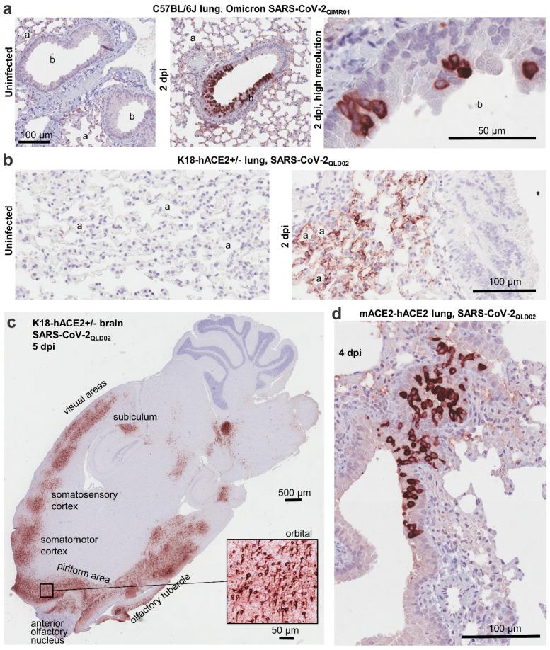 https://cdn.ncbi.nlm.nih.gov/pmc/blobs/59c7/9863740/d89aefe073b5/viruses-15-00139-g001.jpg