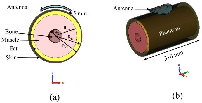 https://cdn.ncbi.nlm.nih.gov/pmc/blobs/59c9/8840389/a78f9cec661d/sensors-22-01276-g019.jpg