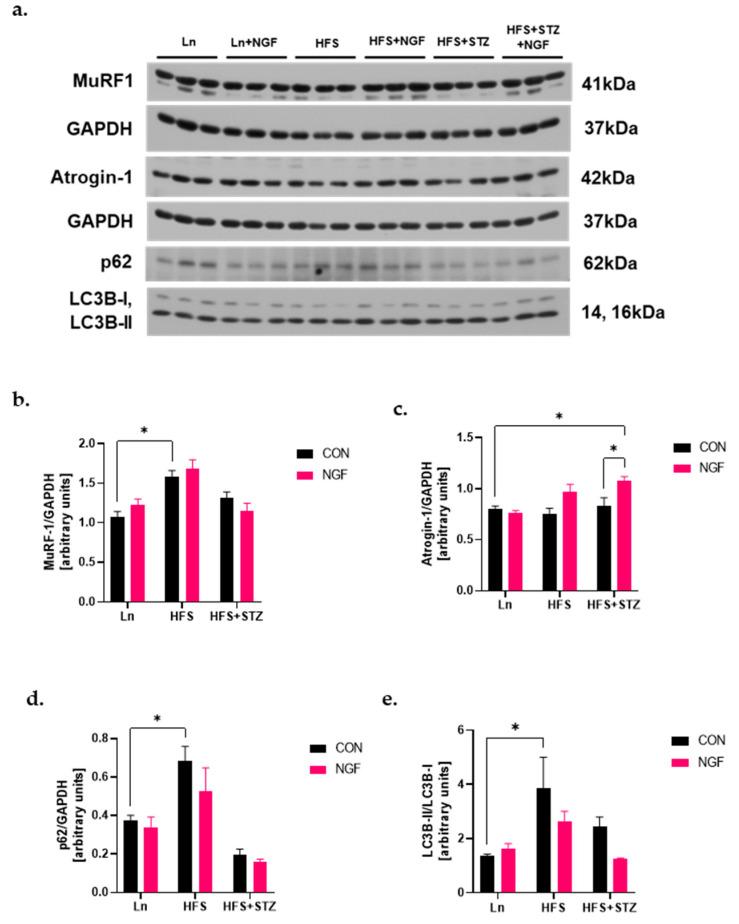 https://cdn.ncbi.nlm.nih.gov/pmc/blobs/59d0/11050157/76116e0deb35/ijms-25-04307-g004.jpg