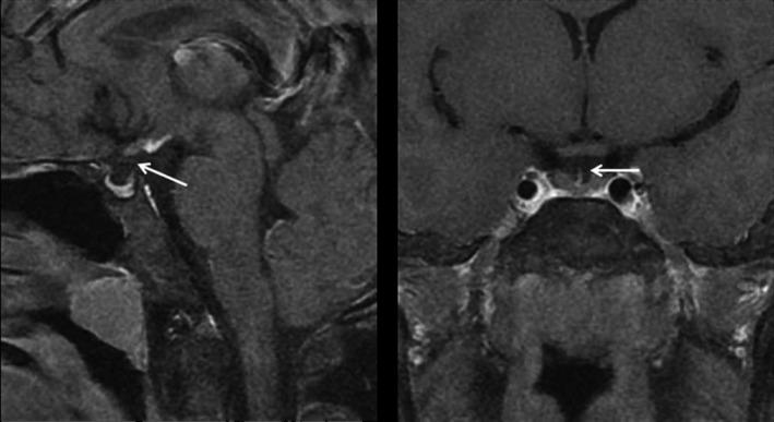 https://cdn.ncbi.nlm.nih.gov/pmc/blobs/59d0/5706574/9d4ca8564ada/JCMM-21-3626-g001.jpg