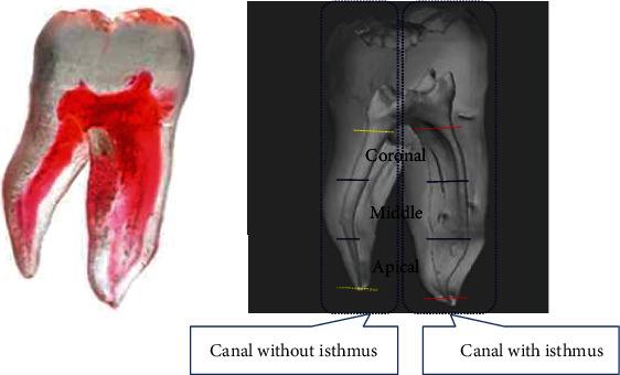 https://cdn.ncbi.nlm.nih.gov/pmc/blobs/59d3/8803455/543d8698c3ee/SCANNING2022-3933305.001.jpg