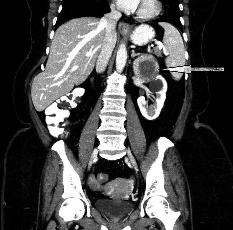 https://cdn.ncbi.nlm.nih.gov/pmc/blobs/59d5/11407686/b0be26b7f78b/cureus-0016-00000067058-i03.jpg