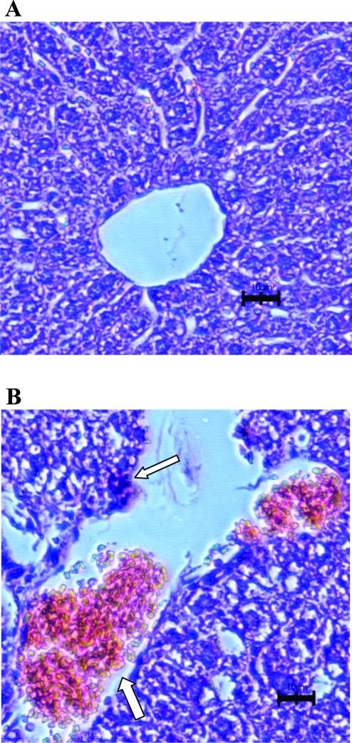 https://cdn.ncbi.nlm.nih.gov/pmc/blobs/59d7/3230245/c151b93ad1e8/mp-2011-00395f_0004.jpg