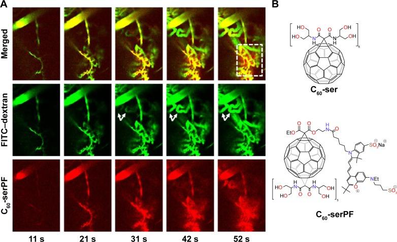 https://cdn.ncbi.nlm.nih.gov/pmc/blobs/59dd/5695510/69fa9c1e2a54/ijn-12-8289Fig4.jpg