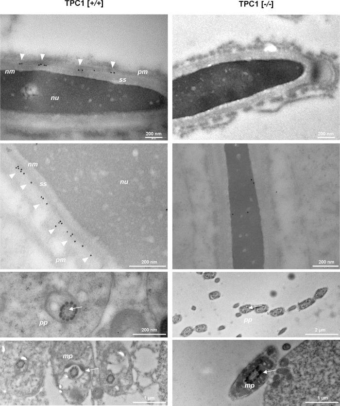 https://cdn.ncbi.nlm.nih.gov/pmc/blobs/59e9/3952862/eadf4eecce51/948fig2.jpg