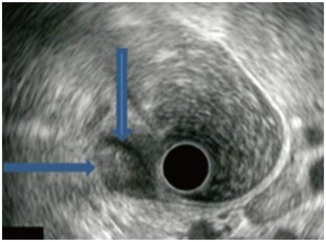 https://cdn.ncbi.nlm.nih.gov/pmc/blobs/59f7/3994265/86d67563a3db/ce-47-197-g002.jpg