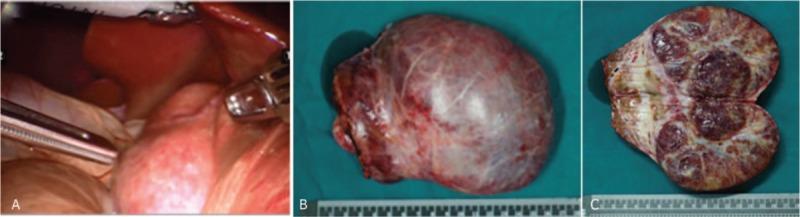 https://cdn.ncbi.nlm.nih.gov/pmc/blobs/59fe/5626121/96f10d9e76f7/medi-96-e7281-g002.jpg