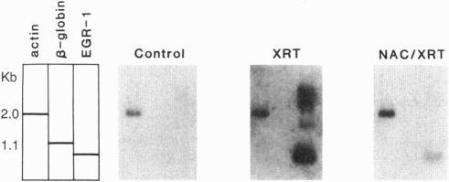 https://cdn.ncbi.nlm.nih.gov/pmc/blobs/59ff/46098/5a42f728a893/pnas01465-0332-b.jpg