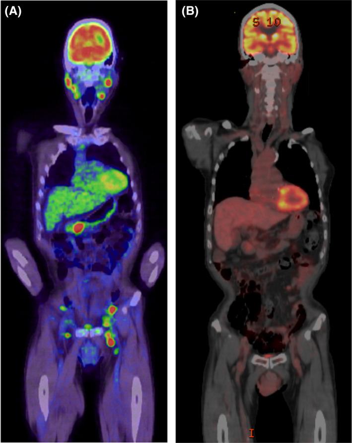 https://cdn.ncbi.nlm.nih.gov/pmc/blobs/5a01/7981704/8c6b92bfc40c/CCR3-9-1344-g001.jpg