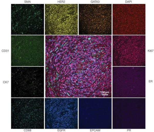 https://cdn.ncbi.nlm.nih.gov/pmc/blobs/5a02/9284190/23e1897e661e/ADVS-9-2200415-g009.jpg