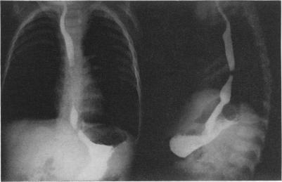 https://cdn.ncbi.nlm.nih.gov/pmc/blobs/5a03/1397071/861ca1e5b2bc/annsurg00402-0090-b.jpg