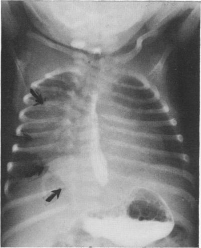 https://cdn.ncbi.nlm.nih.gov/pmc/blobs/5a03/1397071/9d4f8685315a/annsurg00402-0091-a.jpg