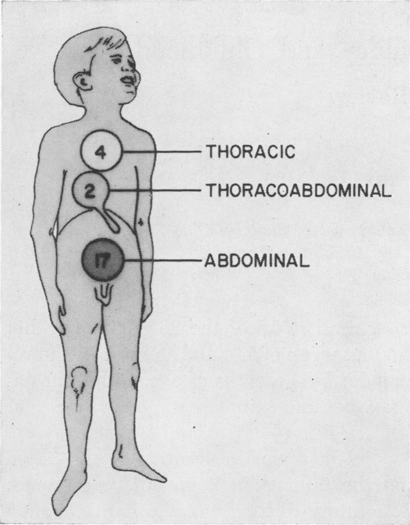 https://cdn.ncbi.nlm.nih.gov/pmc/blobs/5a03/1397071/d39e137615ad/annsurg00402-0089-a.jpg