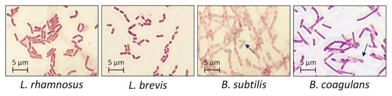 https://cdn.ncbi.nlm.nih.gov/pmc/blobs/5a10/7874009/db4a5e1d0853/fmicb-11-620626-g002.jpg