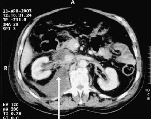 https://cdn.ncbi.nlm.nih.gov/pmc/blobs/5a12/1891787/6f8598e0e5c7/umj7501-085-f2b.jpg
