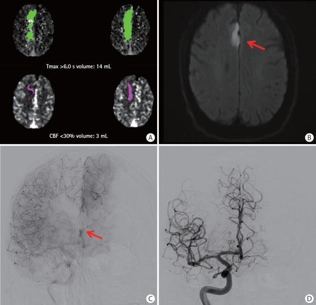 https://cdn.ncbi.nlm.nih.gov/pmc/blobs/5a14/11164590/04251c96e1c4/jos-2023-02649f2.jpg