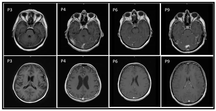 https://cdn.ncbi.nlm.nih.gov/pmc/blobs/5a14/9412690/0f85d1c669b0/tropicalmed-07-00185-g001.jpg