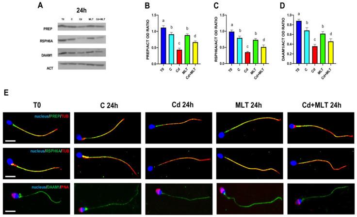 https://cdn.ncbi.nlm.nih.gov/pmc/blobs/5a18/9100642/931a436436d2/ijms-23-05128-g005.jpg