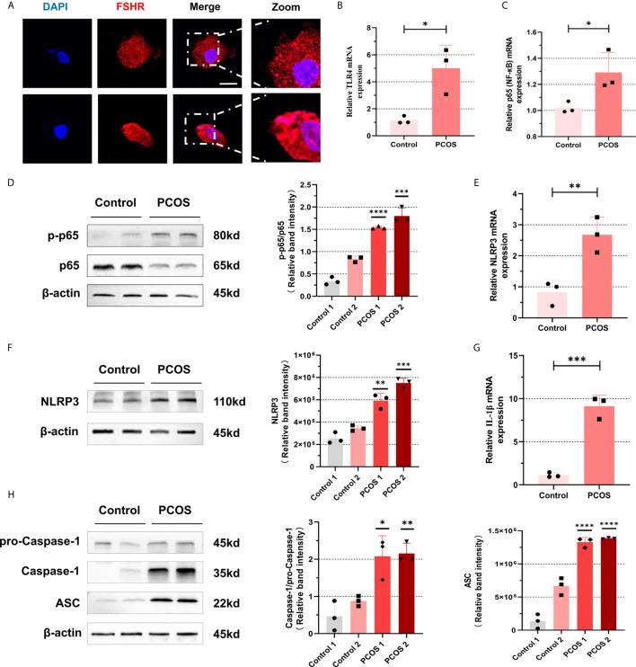 https://cdn.ncbi.nlm.nih.gov/pmc/blobs/5a19/8165443/1a37a671758d/fimmu-12-685724-g002.jpg