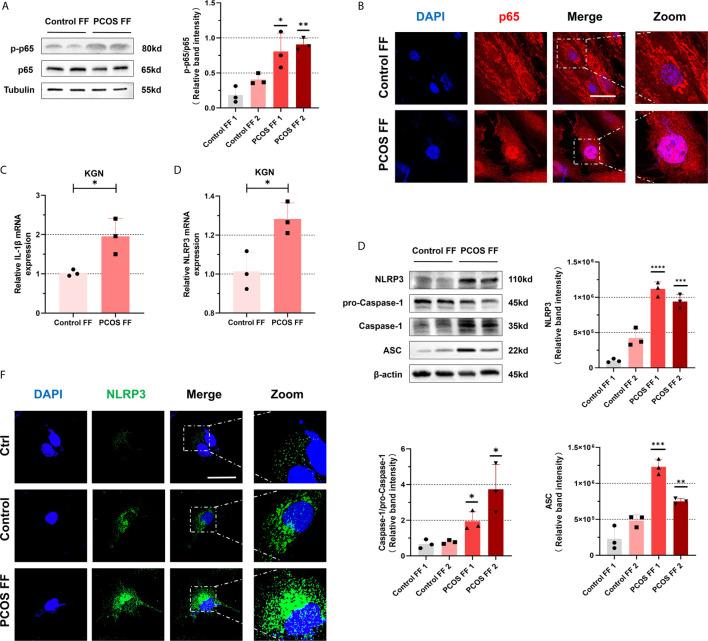 https://cdn.ncbi.nlm.nih.gov/pmc/blobs/5a19/8165443/644aafcfef6e/fimmu-12-685724-g005.jpg