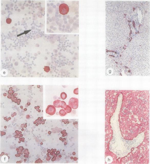 https://cdn.ncbi.nlm.nih.gov/pmc/blobs/5a1a/502333/683f2f30936c/jclinpath00393-0040-a.jpg