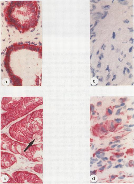 https://cdn.ncbi.nlm.nih.gov/pmc/blobs/5a1a/502333/86a7251696b7/jclinpath00393-0039-a.jpg