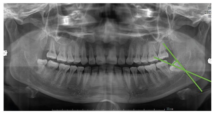 https://cdn.ncbi.nlm.nih.gov/pmc/blobs/5a23/11365053/50952a6ec4f5/medoral-29-e634-g003.jpg