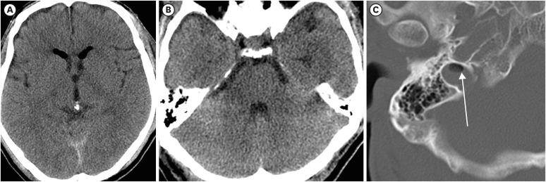 https://cdn.ncbi.nlm.nih.gov/pmc/blobs/5a2b/8093019/3665635c00a2/kjn-17-54-g002.jpg