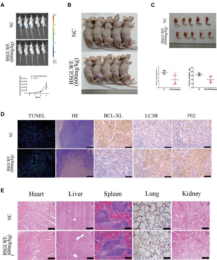 https://cdn.ncbi.nlm.nih.gov/pmc/blobs/5a2f/6942530/28430fe72754/OTT-12-11651-g0005.jpg