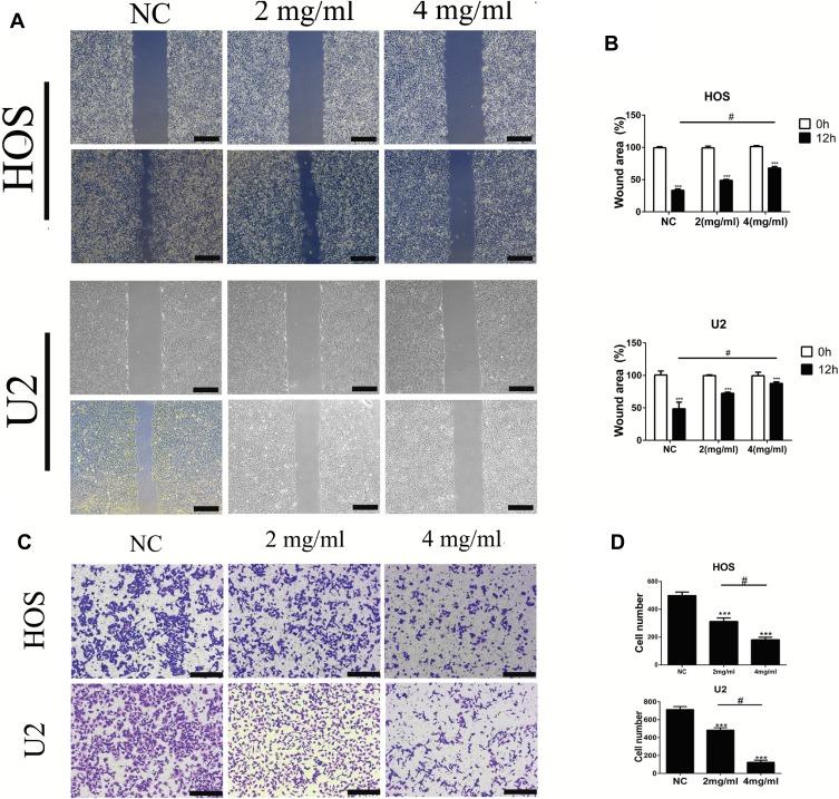 https://cdn.ncbi.nlm.nih.gov/pmc/blobs/5a2f/6942530/2a34876ac750/OTT-12-11651-g0002.jpg