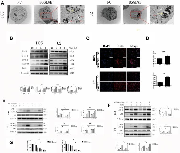 https://cdn.ncbi.nlm.nih.gov/pmc/blobs/5a2f/6942530/c453b8ff95bf/OTT-12-11651-g0004.jpg