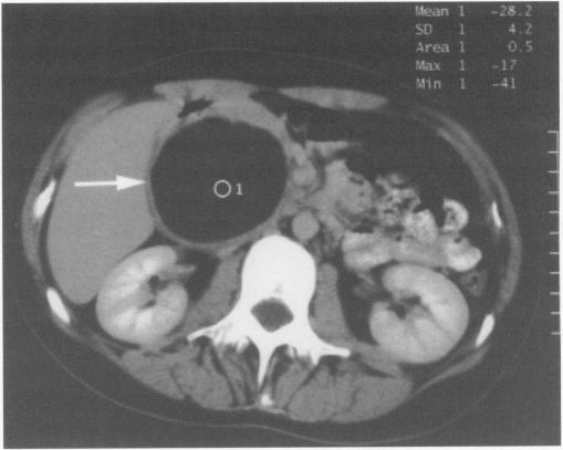 https://cdn.ncbi.nlm.nih.gov/pmc/blobs/5a35/2475458/1e0d8e67c223/ulstermedj00004-0060-b.jpg