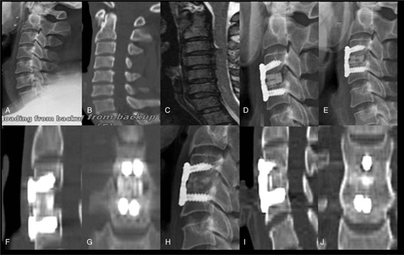https://cdn.ncbi.nlm.nih.gov/pmc/blobs/5a35/6855611/b81fe344a560/medi-98-e17935-g005.jpg