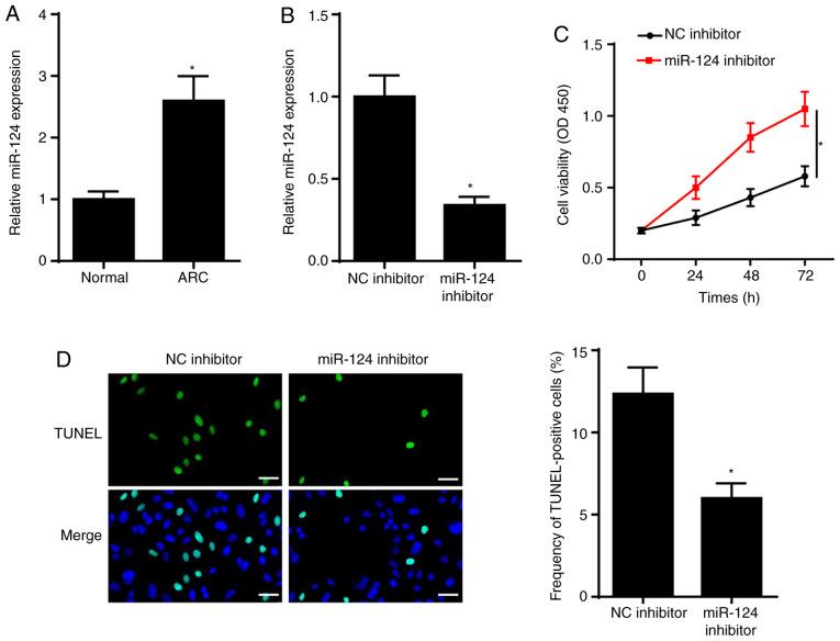 https://cdn.ncbi.nlm.nih.gov/pmc/blobs/5a35/7986009/8f665b73e0f0/mmr-23-05-12020-g00.jpg