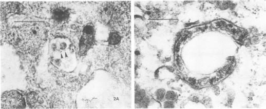 https://cdn.ncbi.nlm.nih.gov/pmc/blobs/5a39/264502/26cda3e33528/iai00134-0390-a.jpg
