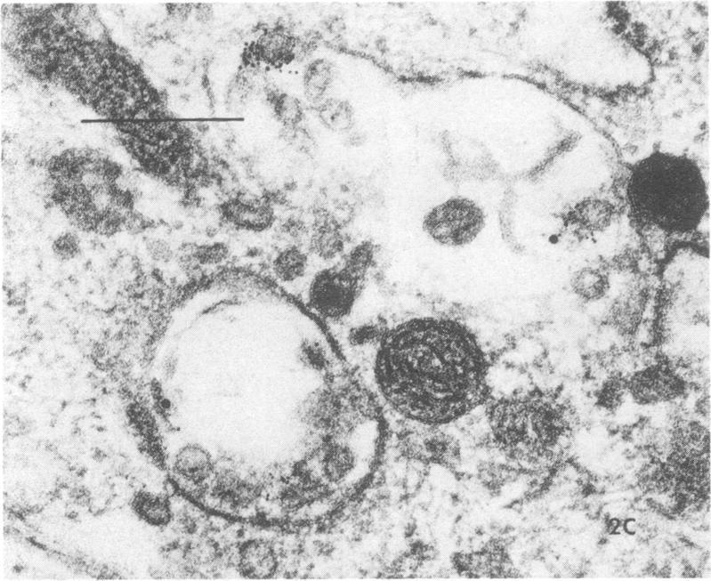 https://cdn.ncbi.nlm.nih.gov/pmc/blobs/5a39/264502/ddfaf7f0074d/iai00134-0390-b.jpg