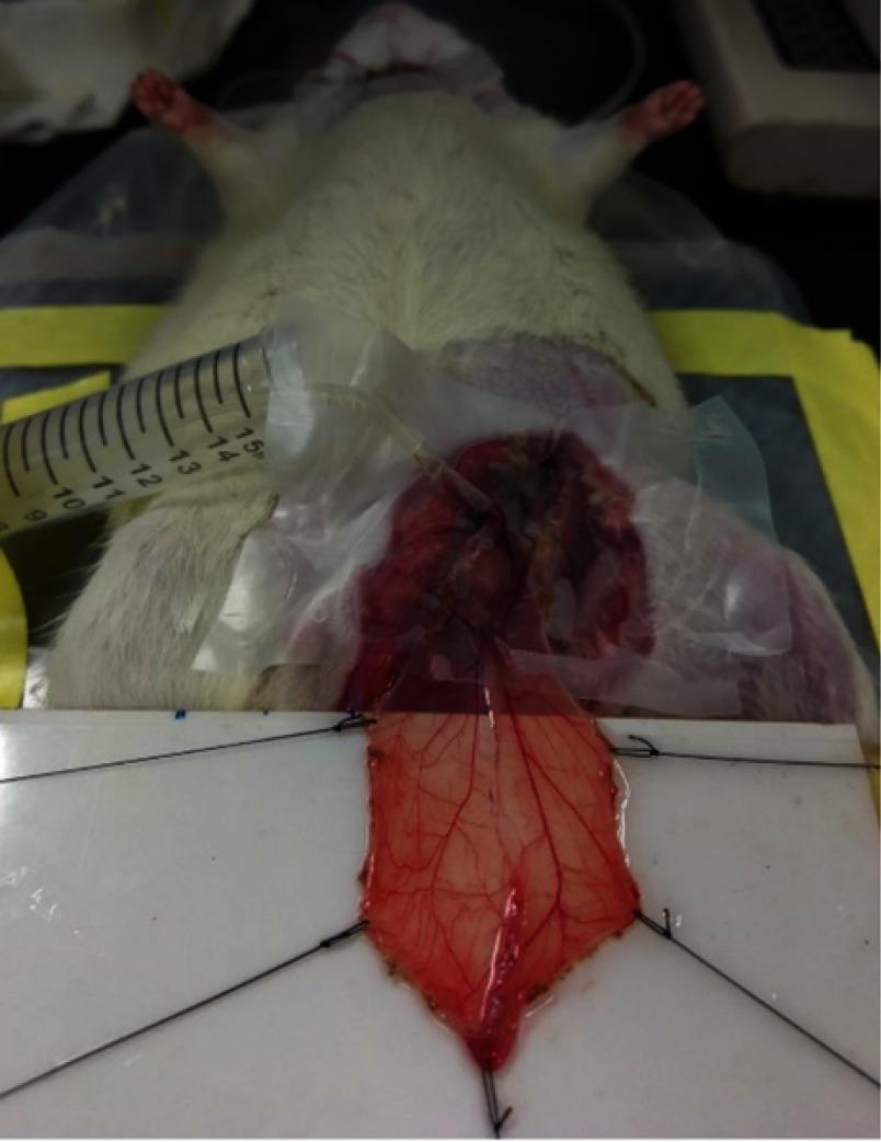 https://cdn.ncbi.nlm.nih.gov/pmc/blobs/5a4b/6613455/6a2c3b711e1c/IJN_A_204844_O_SF0001g.jpg
