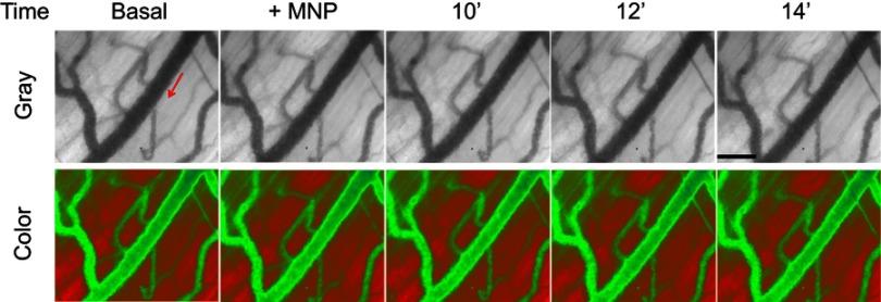 https://cdn.ncbi.nlm.nih.gov/pmc/blobs/5a4b/6613455/adcc2d168c21/IJN_A_204844_O_SF0003g.jpg