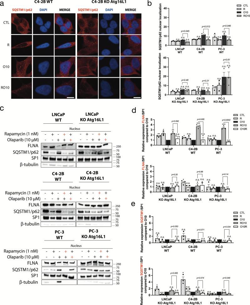 https://cdn.ncbi.nlm.nih.gov/pmc/blobs/5a4f/8940895/21fe0647f7b5/42003_2022_3210_Fig5_HTML.jpg