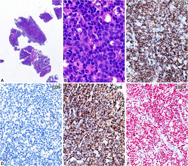 https://cdn.ncbi.nlm.nih.gov/pmc/blobs/5a56/12222570/a1dc1ff541ba/44313_2025_88_Fig1_HTML.jpg