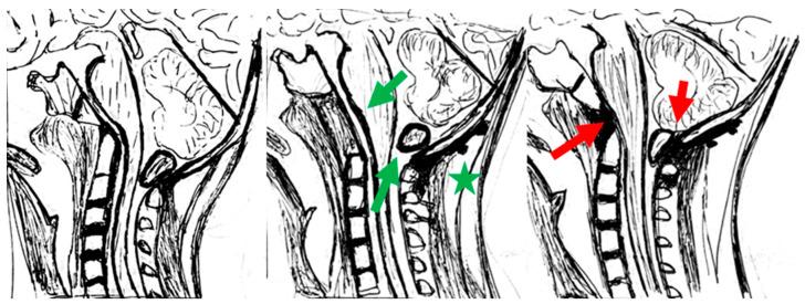 https://cdn.ncbi.nlm.nih.gov/pmc/blobs/5a58/11505955/0d2220e7a2f3/brainsci-14-01006-g001.jpg
