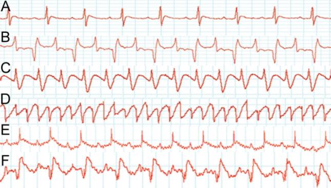 https://cdn.ncbi.nlm.nih.gov/pmc/blobs/5a62/7907149/14c5135d2afc/41598_2021_84056_Fig1_HTML.jpg