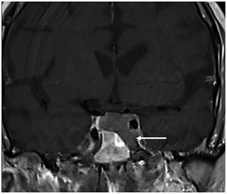 https://cdn.ncbi.nlm.nih.gov/pmc/blobs/5a63/11795648/6a4dffafa4cb/luaf001f1.jpg