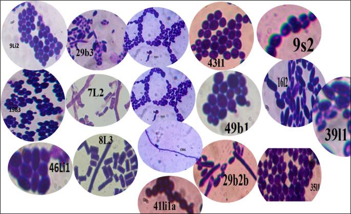 https://cdn.ncbi.nlm.nih.gov/pmc/blobs/5a63/12034024/115f4c776140/f1000research-14-179817-g0003.jpg