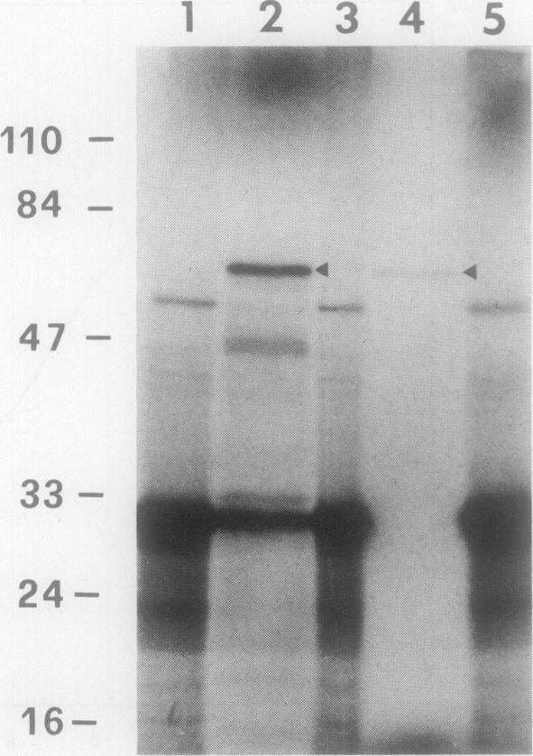 https://cdn.ncbi.nlm.nih.gov/pmc/blobs/5a63/208968/4e9fa5f965ba/jbacter01038-0066-a.jpg